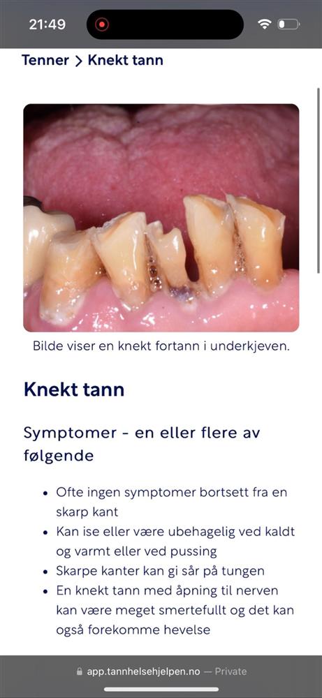 Fra app&#39;n &quot;Tannhelsehjelpen&quot; beskrivelse av symtomber ved knekt tann - Klikk for stort bilde